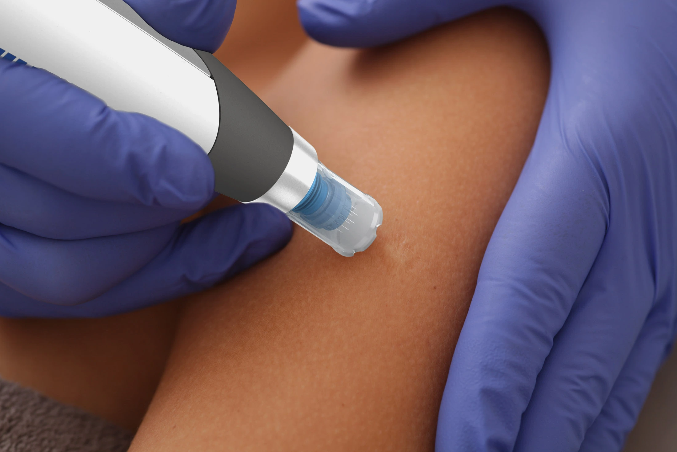 The_Face_&_Body_MediSpa_Website_Dermapen_4-2 The Face & Body MediSpa Dermapen 4 treatment is a next-generation microneedling treatment designed to rejuvenate the skin by stimulating its natural repair processes.