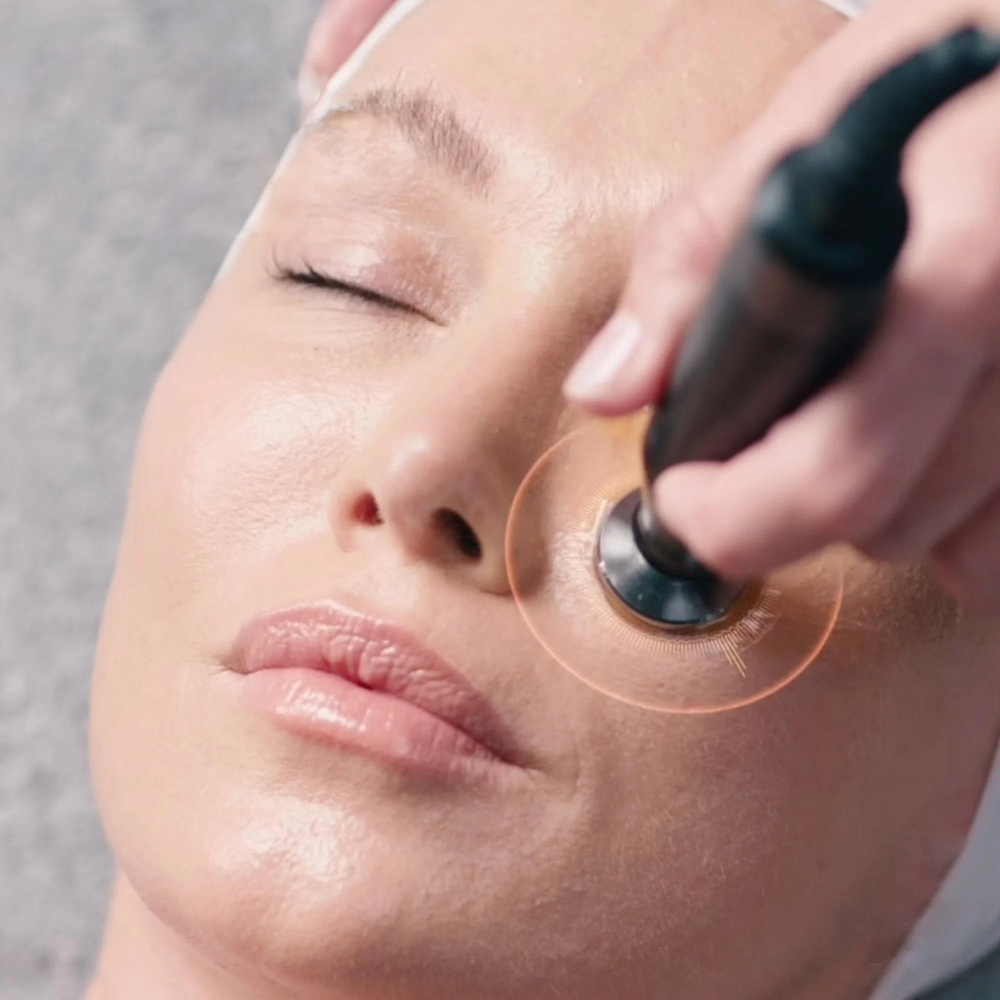 This targeted, non-invasive treatment at The Face & Body MediSpa is designed to soften the appearance of facial lines and enhance areas that need a subtle boost of volume.