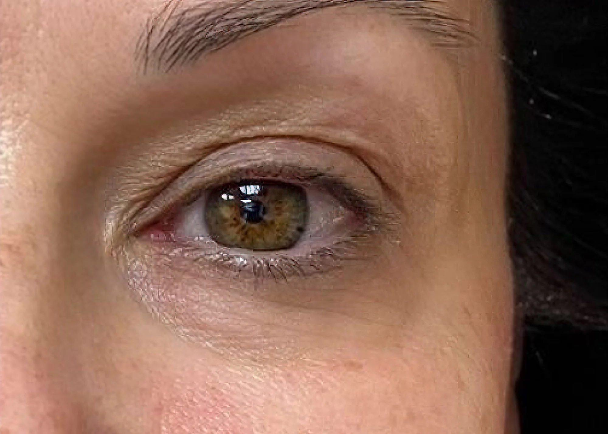 Before and after treatment results photos at The Face & Body MediSpa of CACI Eve Revive treatment