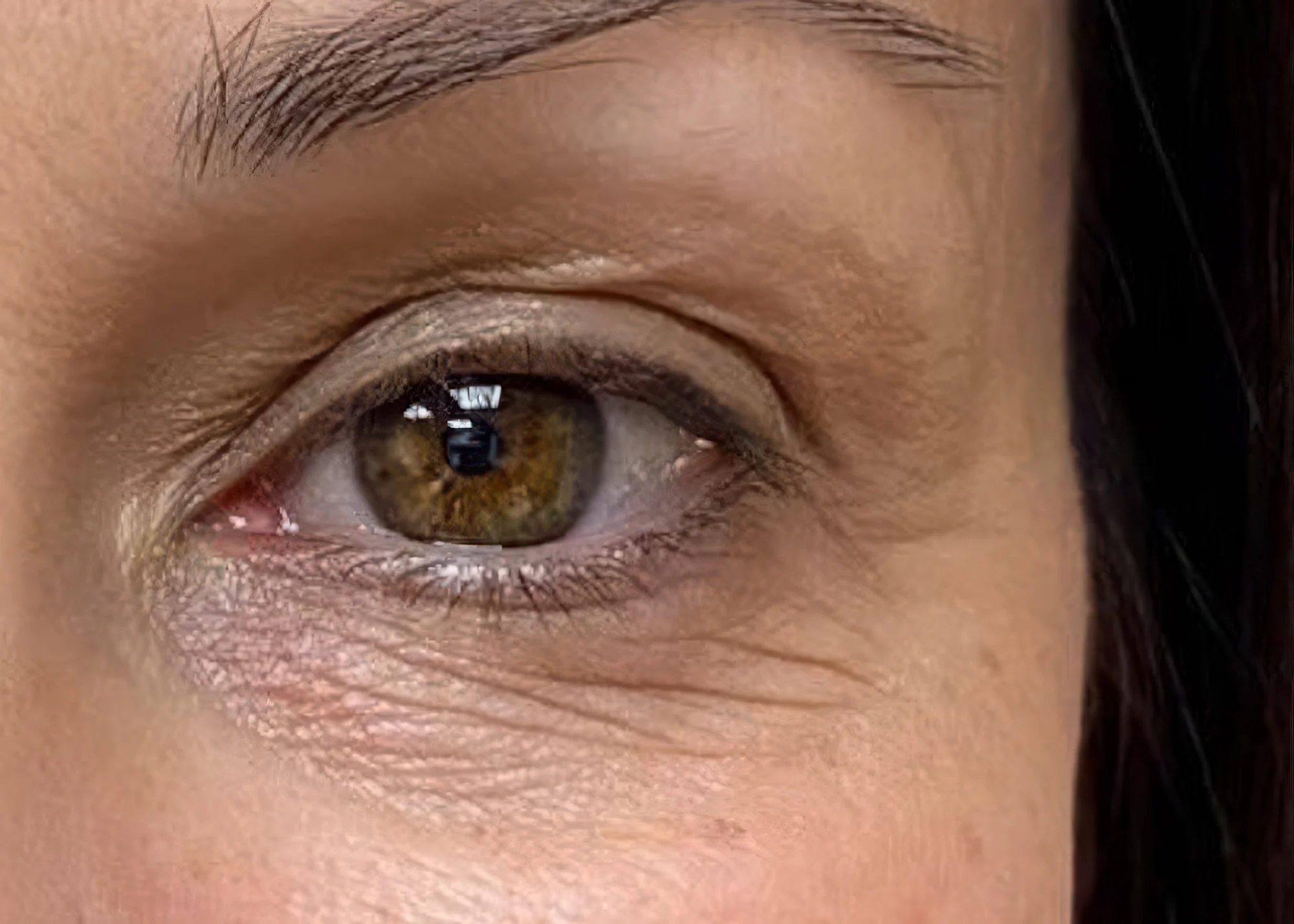 Before and after treatment results photos at The Face & Body MediSpa of CACI Eve Revive treatment