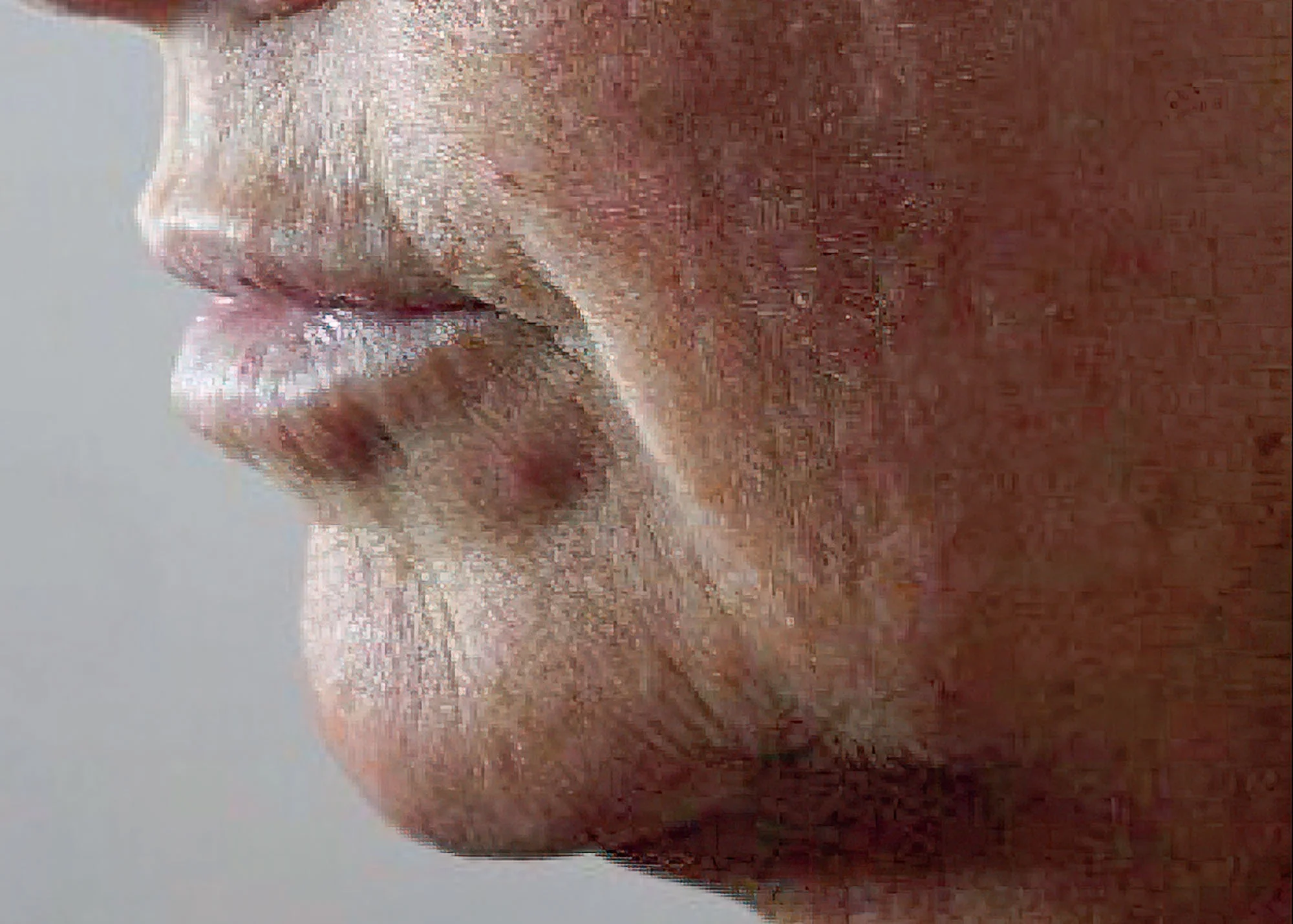 Before and after treatment results photos at The Face & Body MediSpa of CACI Jowl Lift treatment