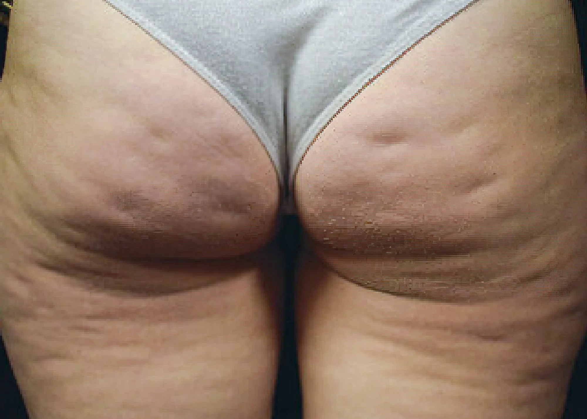 Before and after treatment results photos at The Face & Body MediSpa of Environ treatment