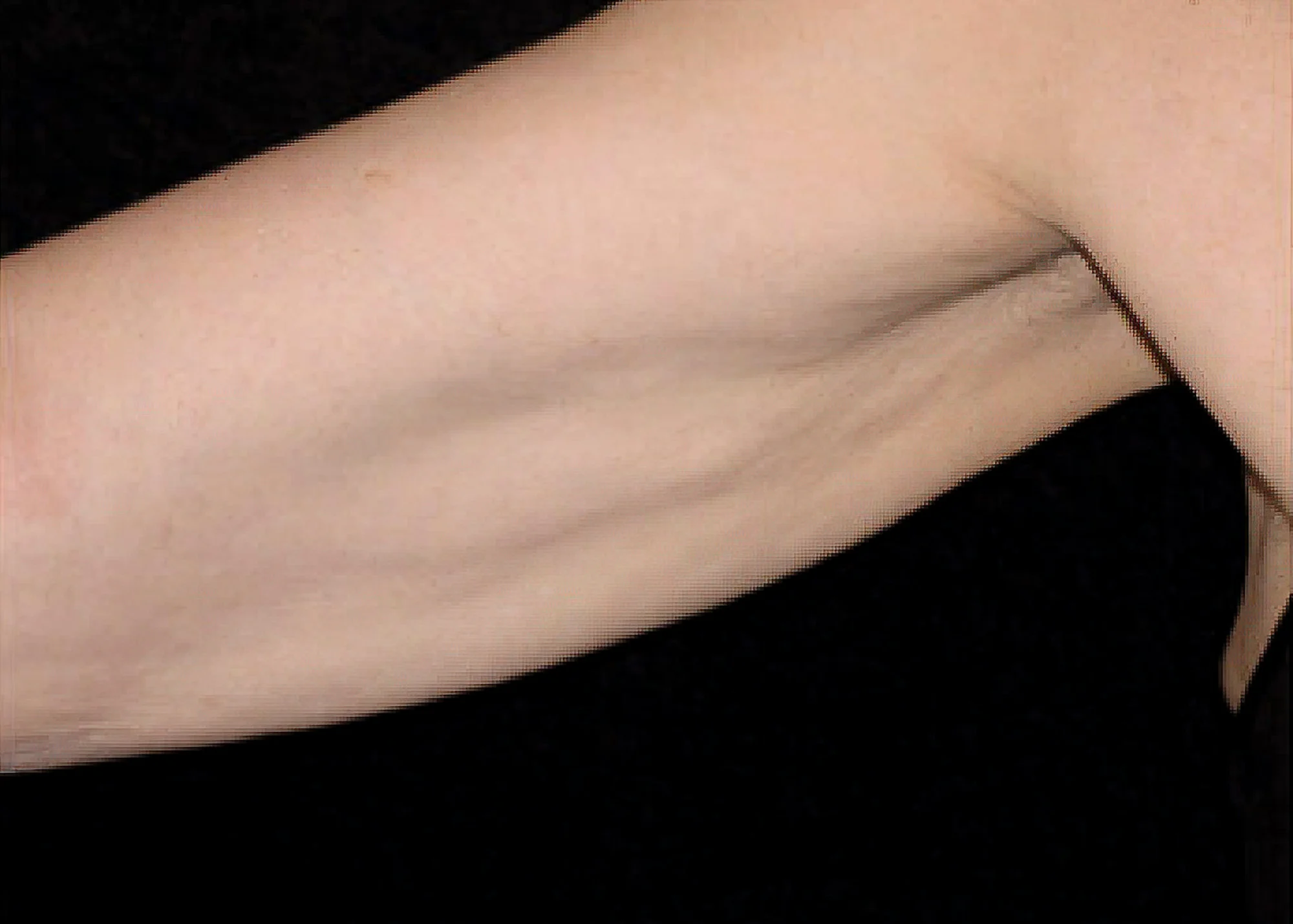 Before and after treatment results photos at The Face & Body MediSpa of Environ treatment