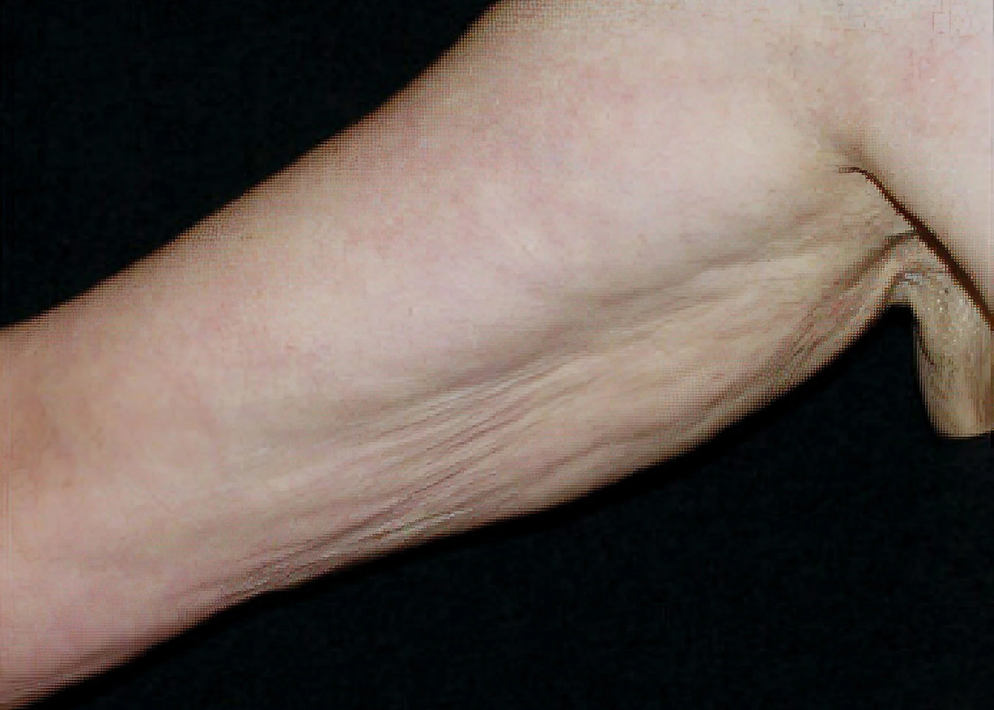 Before and after treatment results photos at The Face & Body MediSpa of Environ treatment