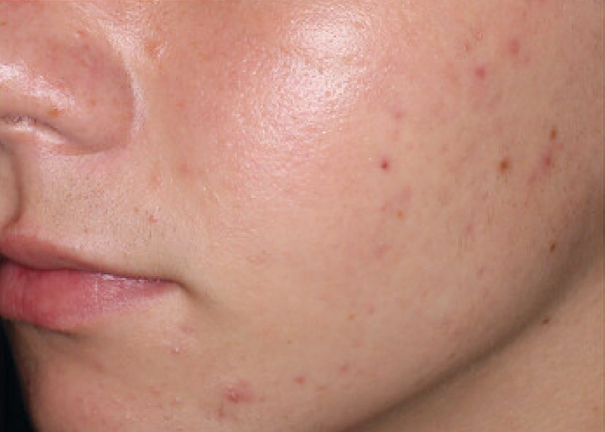 Before and after treatment results photos at The Face & Body MediSpa of Environ treatment