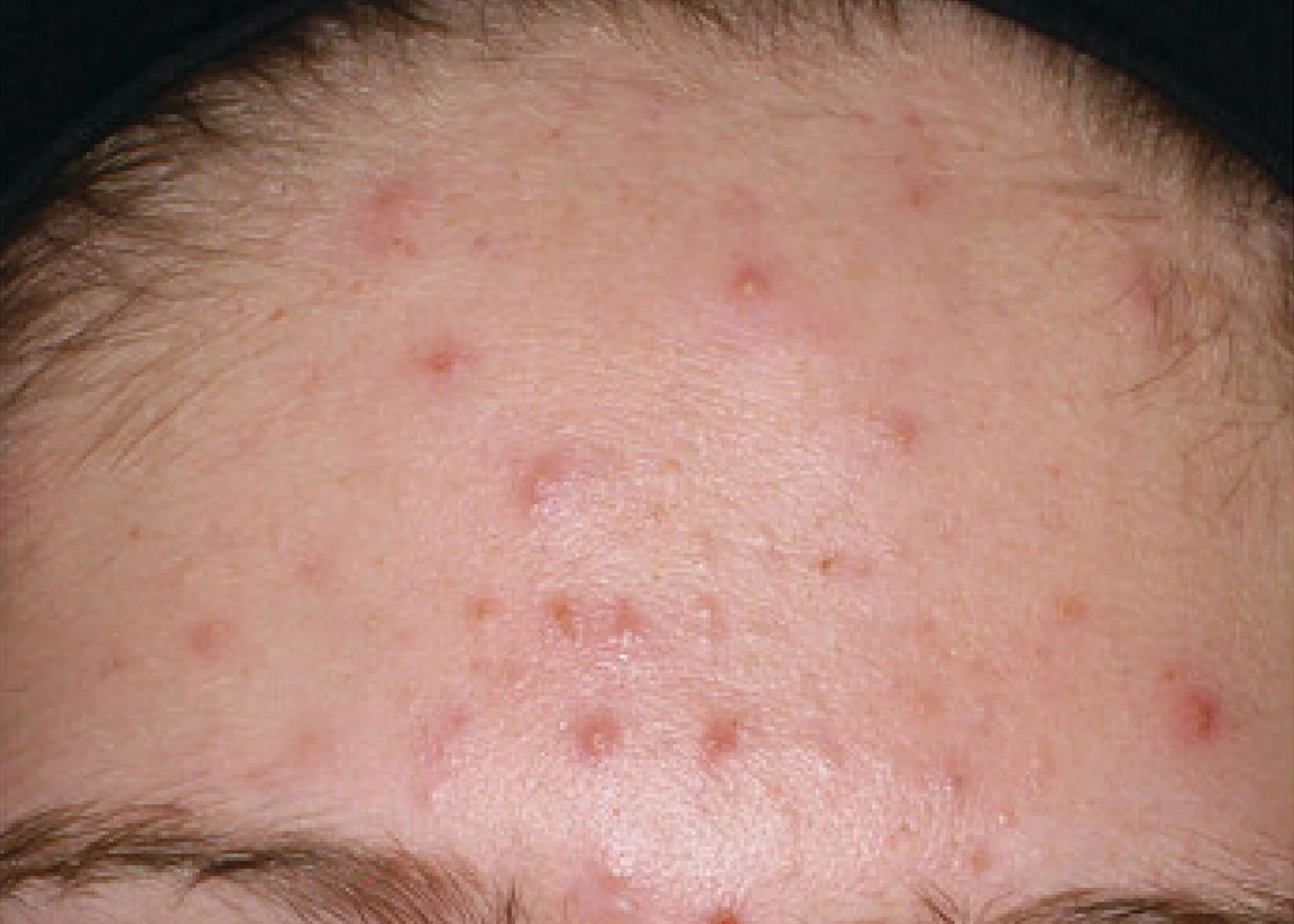 Before and after treatment results photos at The Face & Body MediSpa of Environ treatment